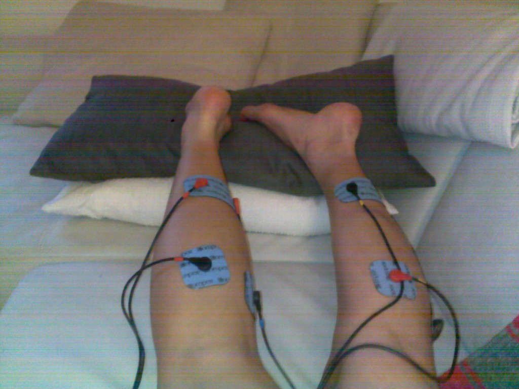 Compex electrotherapy